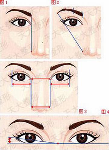 韩式三点双眼皮手术过程(图)